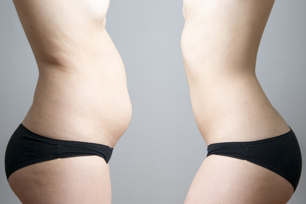coolsculpting facts for weight loss